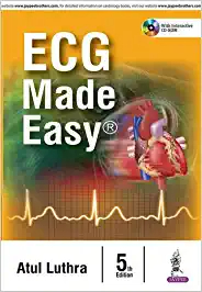 ECG Made Easy (With Interactive CD-ROM) by Atul Luthra  (Author)